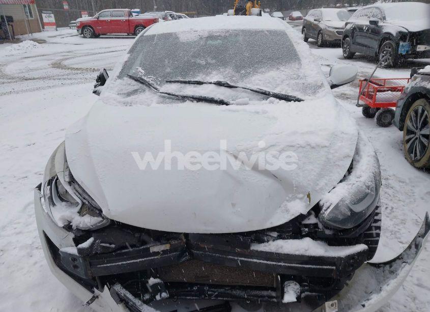 Photo 12 of 2016 Hyundai Elantra SE (VIN 5NPDH4AE5GH734027)