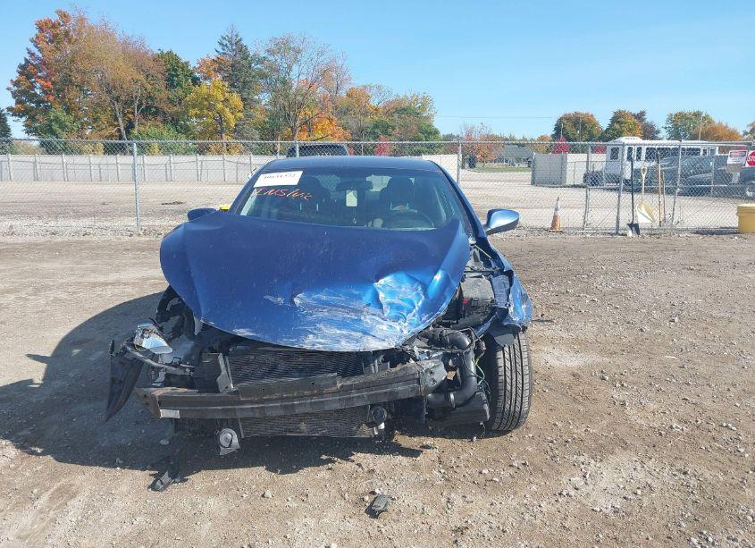 Photo 12 of 2016 Hyundai Elantra SE (VIN 5NPDH4AE5GH761115)