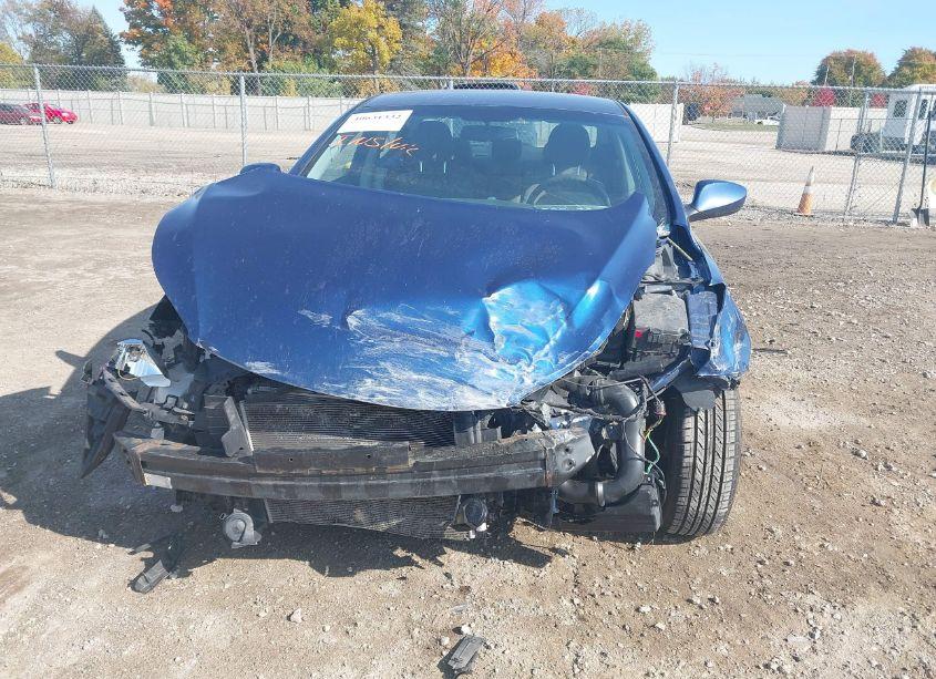 Photo 6 of 2016 Hyundai Elantra SE (VIN 5NPDH4AE5GH761115)