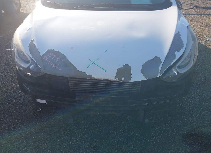 Photo 13 of 2016 Hyundai Elantra SE (VIN 5NPDH4AE7GH796805)