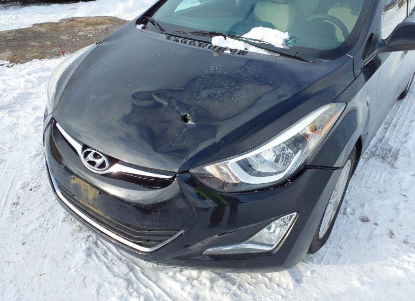 Photo 6 of 2015 Hyundai Elantra SE (VIN 5NPDH4AE8FH577933)