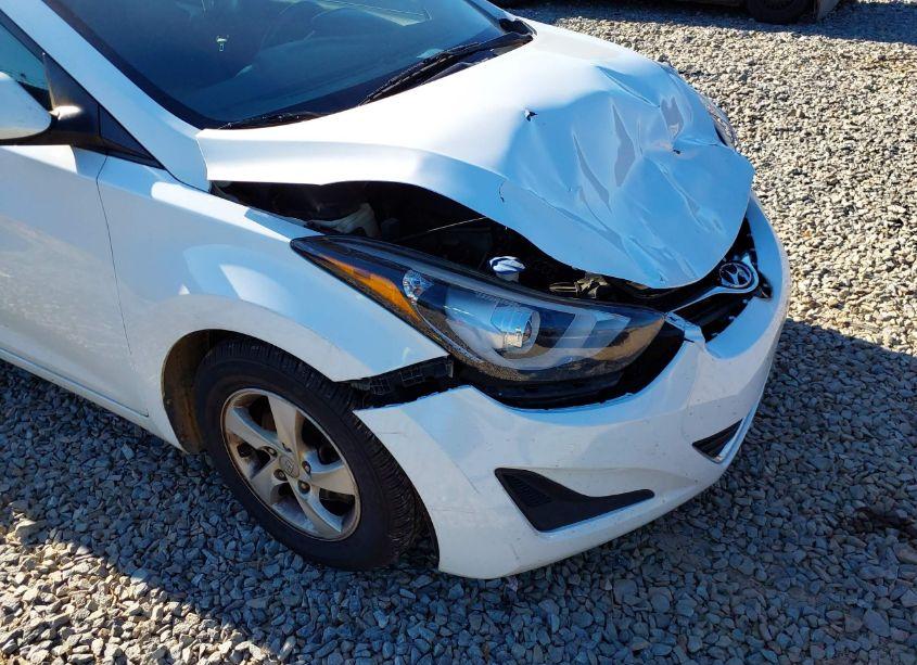 Photo 17 of 2015 Hyundai Elantra SE (VIN 5NPDH4AE8FH629917)