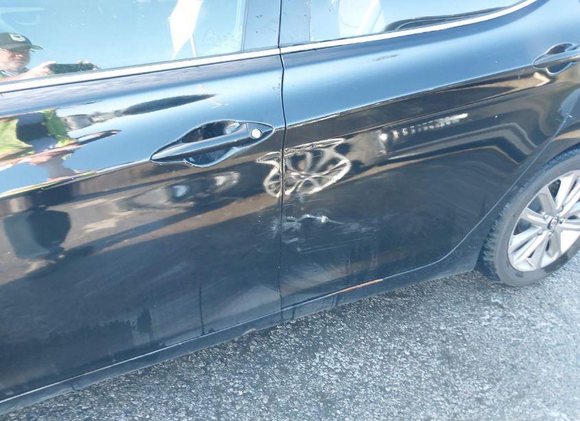 Photo 6 of 2015 Hyundai Elantra SE (VIN 5NPDH4AE8FH636379)