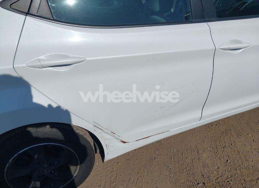 Photo 6 of 2015 Hyundai Elantra SE (VIN 5NPDH4AE8FH651884)