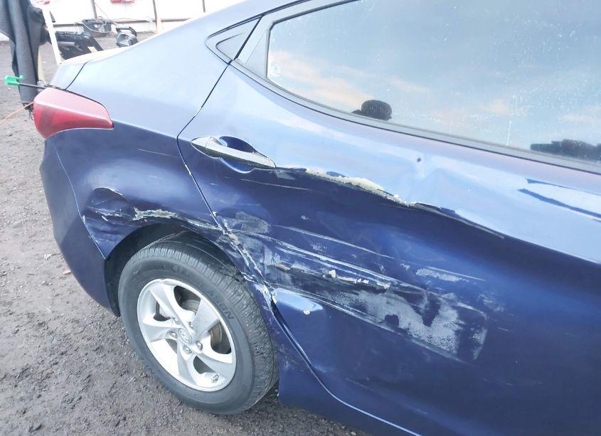 Photo 6 of 2014 Hyundai Elantra SE (VIN 5NPDH4AE9EH529761)