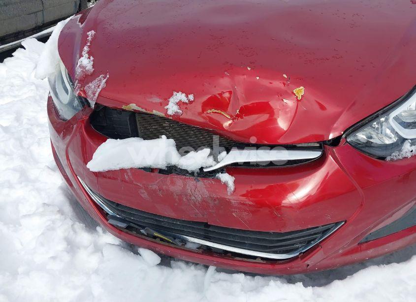 Photo 6 of 2014 Hyundai Elantra SE (VIN 5NPDH4AE9EH536046)