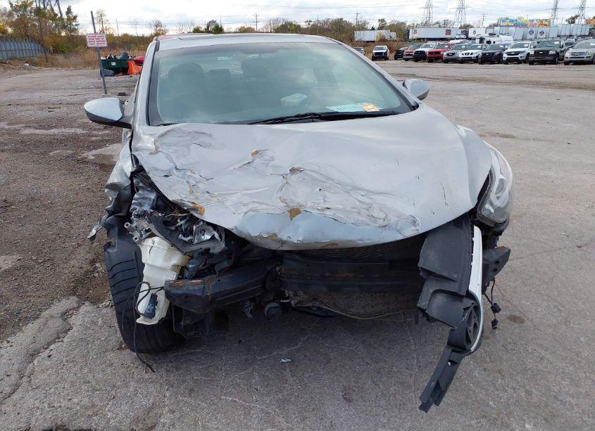 Photo 6 of 2015 Hyundai Elantra SE (VIN 5NPDH4AEXFH599058)