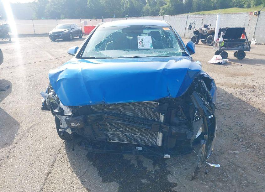 Photo 12 of 2018 Hyundai Sonata SE (VIN 5NPE24AF0JH691657)