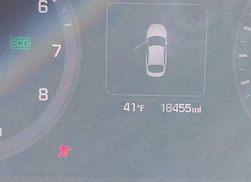 Photo 15 of 2017 Hyundai Sonata SPORT (VIN 5NPE34AF8HH472758)