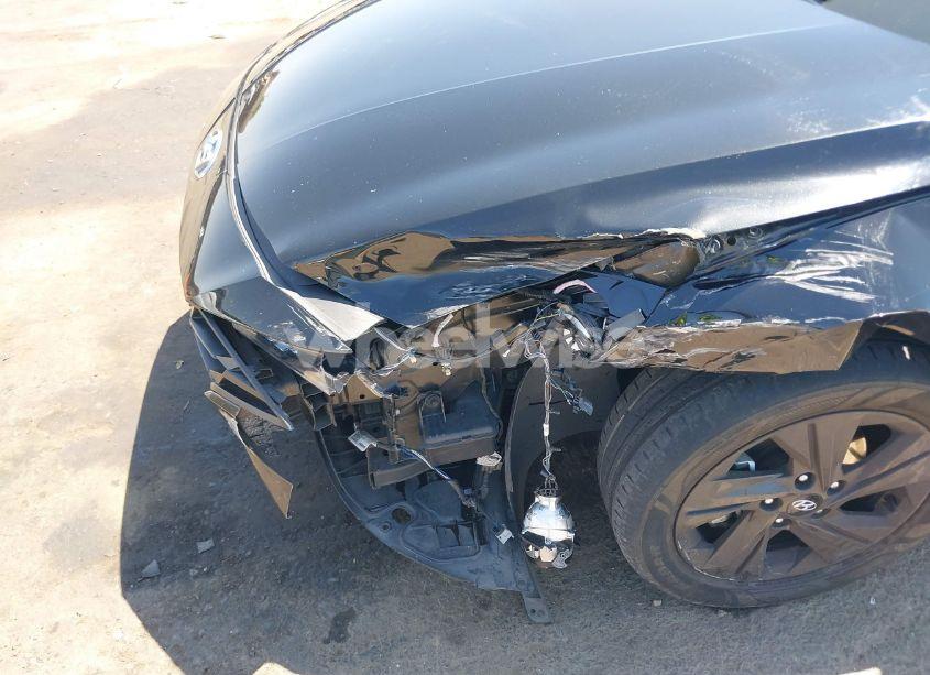 Photo 6 of 2022 Hyundai Elantra SEL (VIN 5NPLM4AG2NH054396)