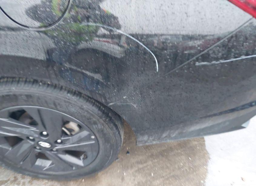 Photo 19 of 2022 Hyundai Elantra SEL (VIN 5NPLM4AG9NH071065)