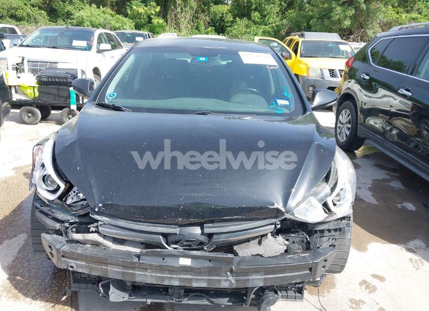 Photo 6 of 2015 Hyundai Elantra LIMITED (VIN KMHDH4AEXFU388041)