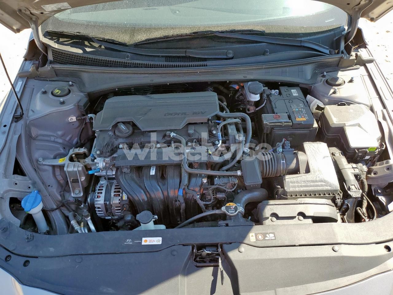 Photo 11 of 2025 HYUNDAI ELANTRA SEL SPORT (VIN KMHLM4DG1SU961682)