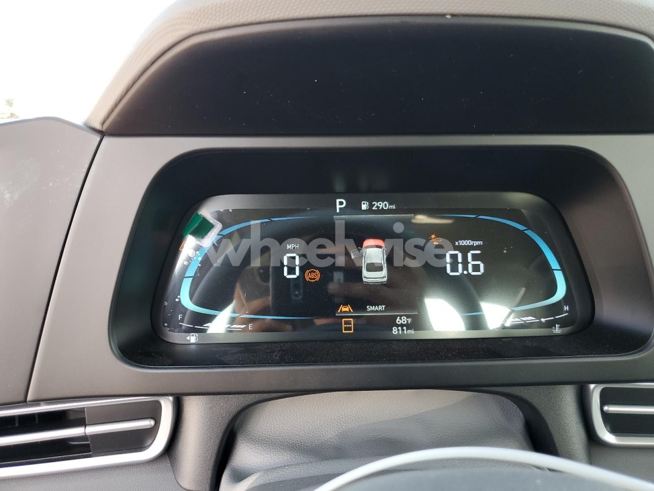 Photo 9 of 2025 HYUNDAI ELANTRA SEL SPORT (VIN KMHLM4DG2SU021293)