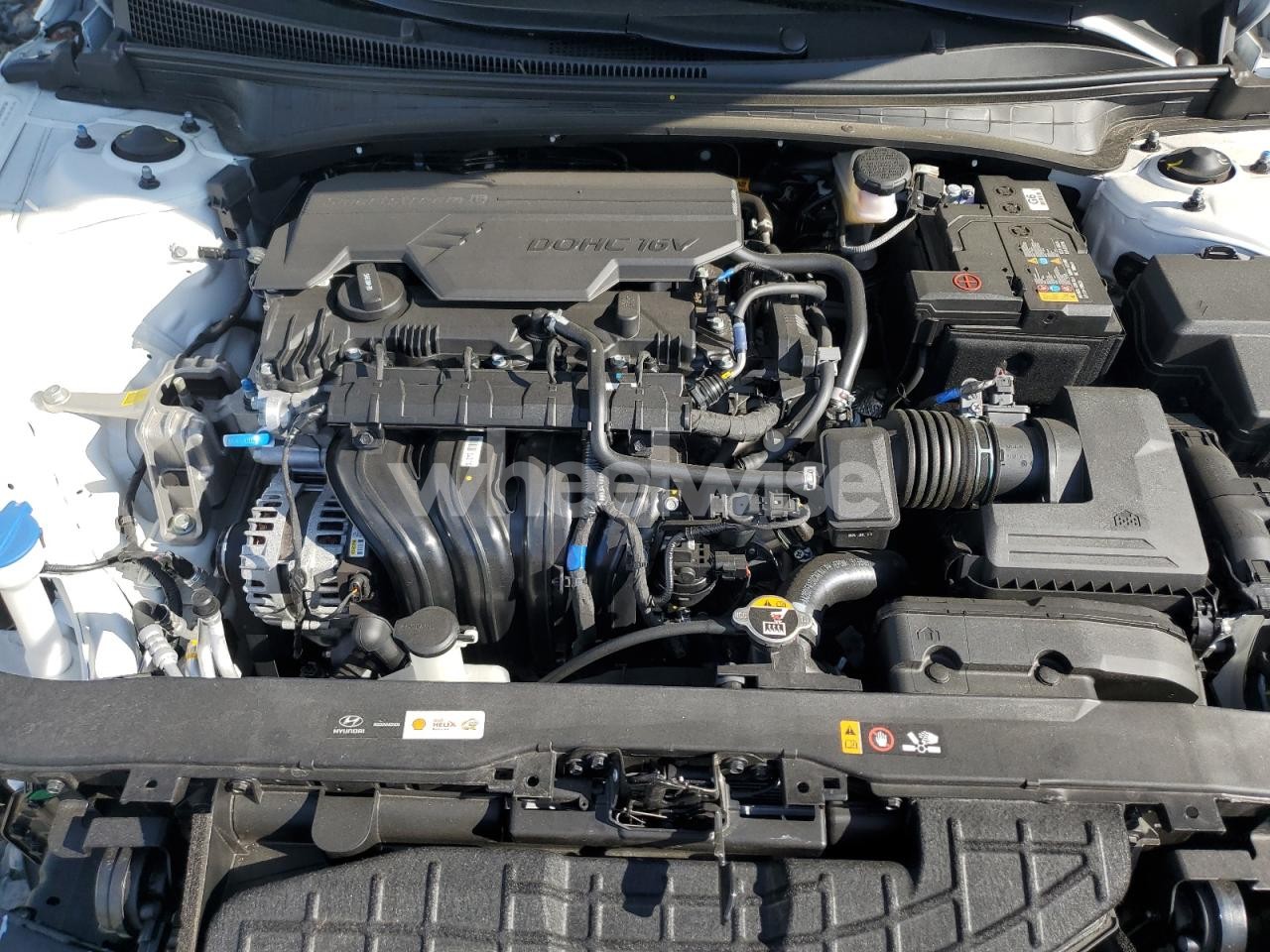 Photo 11 of 2025 HYUNDAI ELANTRA SEL SPORT (VIN KMHLM4DG4SU894592)