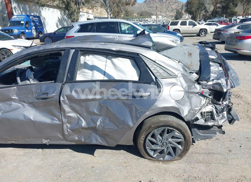 Photo 11 of 2024 Hyundai Elantra SEL (VIN KMHLM4DG8RU679405)