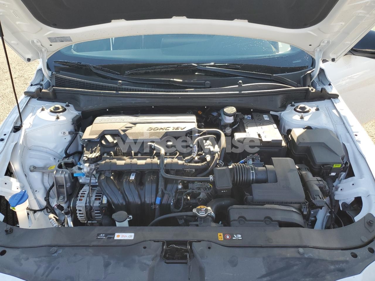 Photo 11 of 2025 HYUNDAI ELANTRA SEL SPORT (VIN KMHLM4DGXSU010431)