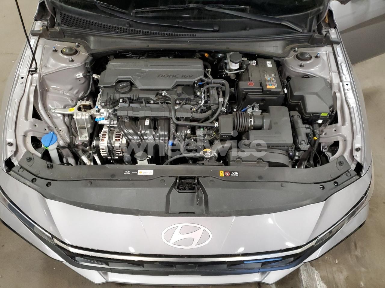 Photo 11 of 2025 HYUNDAI ELANTRA SEL (VIN KMHLS4DG4SU019437)