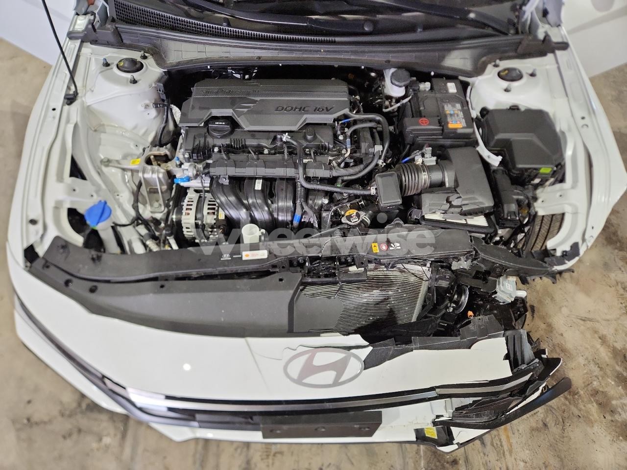 Photo 11 of 2025 HYUNDAI ELANTRA SEL (VIN KMHLS4DG4SU024184)