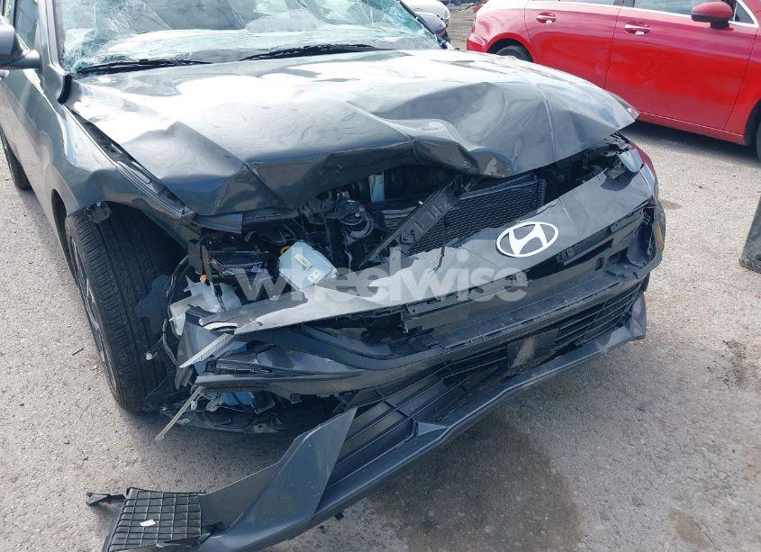 Photo 6 of 2024 Hyundai Elantra SEL (VIN KMHLS4DG8RU841099)